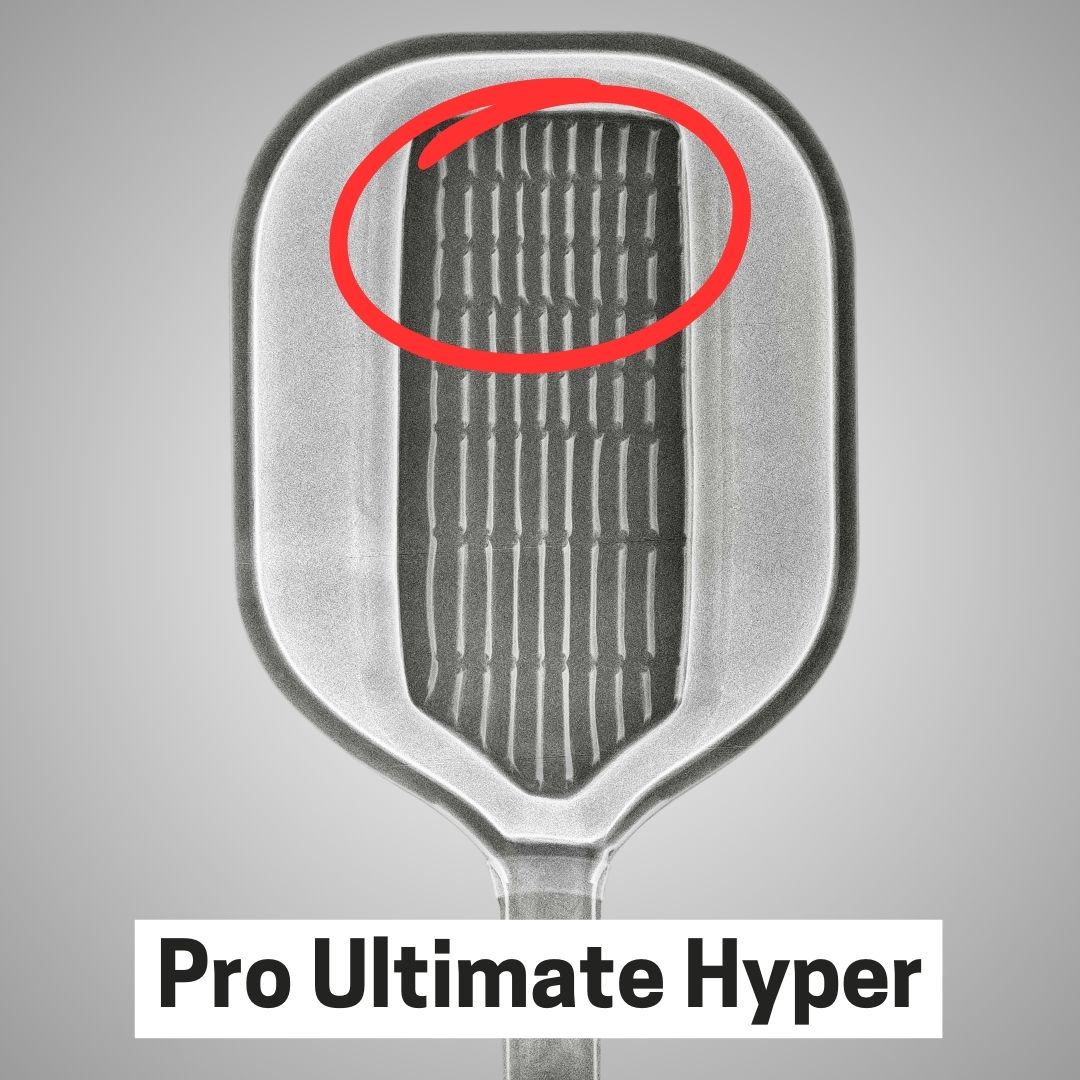 Gearbox Ultimate Pro Hyper X Ray Sweet Spot